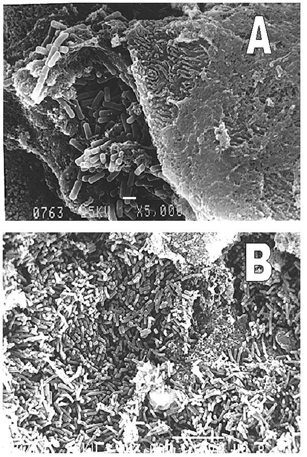 Representative biofilms on nasogastric tubes showing bacterial organisms with typical form of Pseudomonas aeruginosa. Scanning electronic microscope. A, scale bar, 1 µm; B, scale bar, 10 µm.