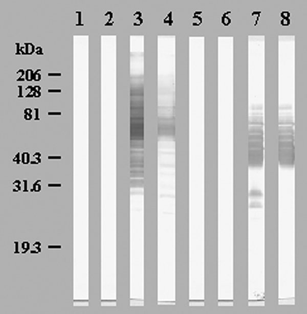 Western blot showing seroconversions in immunoglobulin (Ig) G (Lanes 1, 3, 5, 7) and IgM (Lanes 2, 4, 6, 8) of patient 2 against Bosea massiliensis (Lanes 1 to 4) and patient 9 against Legionella anisa (Lanes 5 to 8). Lanes 1, 2, 5, 6: acute-phase sera; Lanes 3, 4, 7, 8: convalescent-phase sera.