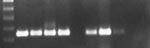 Thumbnail of West Nile virus (WNV) reverse transcription-polymerase chain reaction results from epizootic die-offs in farm-raised alligators. The expected amplicon is 248 bp. Lane 1, a 100-bp molecular weight ladder. Lane 2, the positive WNV control. Lane 3, fresh tissue samples from a juvenile alligator in the 2002 epizootic. Lane 4, virus isolation cell homogenate from a juvenile alligator in the 2002 epizootic. Lane 5, horsemeat that was being fed to alligators during the 2002 epizootic. Lane