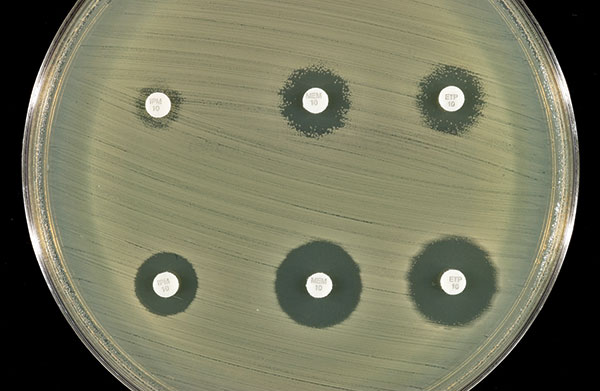 Effect of addition of clavulanic acid (10 μL of 1,000 μg/mL) to the zones of inhibition of the three carbapenem disks. Top row (left to right): imipenem, meropenem, and ertapenem disks without clavulanic acid. Bottom row (left to right): imipenem, meropenem, and ertapenem disks with clavulanic acid.