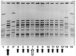 Thumbnail of Molecular epidemiology of group A streptococcus (GAS) strains in outbreak. Pulsed field gel electrophoresis, demonstrating relatedness of group A streptococcal isolates from an person with clinical illness from GAS, a person with chronic colonization with GAS, and asymptomatically colonized facility staff and residents. Lanes 1 and 15 contain an ATCC quality control strain. Lane 14 contains an isolate from another nursing facility, unrelated to outbreak 1. The isolate in lane 2 (lar
