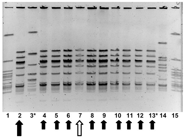 Molecular epidemiology of group A streptococcus (GAS) strains in outbreak. Pulsed field gel electrophoresis, demonstrating relatedness of group A streptococcal isolates from an person with clinical illness from GAS, a person with chronic colonization with GAS, and asymptomatically colonized facility staff and residents. Lanes 1 and 15 contain an ATCC quality control strain. Lane 14 contains an isolate from another nursing facility, unrelated to outbreak 1. The isolate in lane 2 (large solid arro