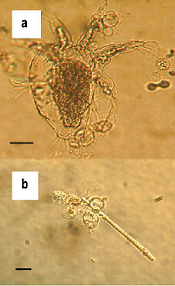 Zoosporangia of strain 98-1810/3 visible as transparent spherical bodies growing in lake water on (a) freshwater arthropod and (b) algae. Bars = 30 μM.