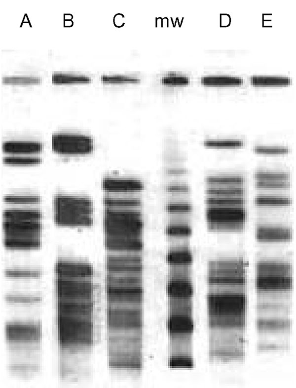 Restriction pattern (XbaI) by pulsed-field gel electrophoresis of the five extended-spectrum, cephalosporin-resistant Escherichia coli clones (A, B, C, D, E). mw: marker.
