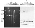 Thumbnail of Plasmid restriction with PstI (A) and hybridization of isolates carrying the CTX-M-9 enzyme with the CTX-M-9 probe (B). The isolates are as listed in Figure 1. Below each line of hybridization, the pattern shown in the Table is indicated.