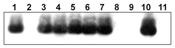 Southern blot analysis of DNA from rabbit Escherichia coli isolates by using a Shiga toxin 1B (stx1B) probe from rabbit enterohemorrhagic E. coli (EHEC) O153:H-. Lane 1, E. coli O157:H7 DNA (EDL 933, human isolate, positive control); lane 2, No DNA; lanes 3–5, O153:H- DNA (rabbit isolates 01-3014, 02-3283, 02-3300, respectively); lanes 6 and 7, O153:H7 DNA (02-3446 and 02-3301); lanes 8 and 9, O145:H- DNA (02-3282 and 02-3055); lane 10, rabbit isolate of unknown O serotype (03-192); lane 11, O14
