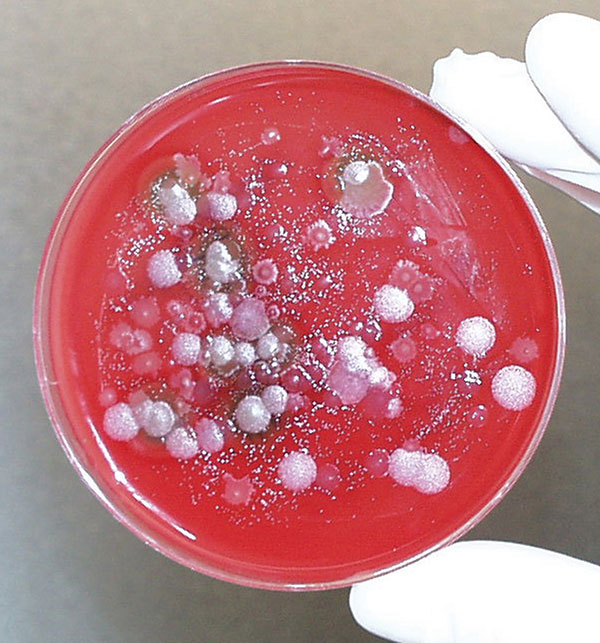 Fluid collected from the Kameido site cultured on Petri dishes to identify potential Bacillus anthracis isolates.