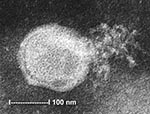 Thumbnail of Electron micrograph of human metapneumovirus collected from the supernatant of rhesus monkey kidney (LLC-MK2) cell culture. A virion releasing nucleocapsid is shown.