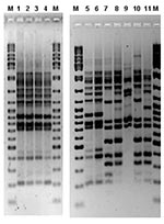 Thumbnail of Amplified fragment length polymorphism (AFLP) gel containing outbreak human and environmental Legionella pneumophila serogroup 1 isolates. M, molecular weight marker (Ladder Mix, MBI Fermentas, UK). Lanes 1 and 2, two colonies from a cooling tower of the hospital H. Lines 3 and 4, human isolates. Lanes 5 and 6, human isolates. Lanes 7–11, different environmental isolates from several Murcia installations.