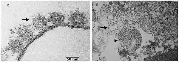 Thin-section electron micrograph of severe acute respiratory syndrome-associated coronavirus grown in Vero E6 cells. Panel A shows extracellular viral particles (arrow) lining the surface of the plasma membrane. Some spikes projecting from the envelope of the virus are seen. Panel B shows numerous spherical coronavirus particles (arrow) within dilated cytoplasmic vacuoles (arrowhead).