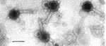 Thumbnail of Electron micrograph of O34 vibriophage. Bar represents 100 nm.