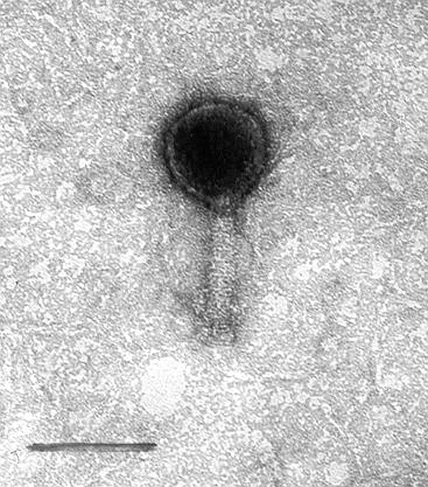 Electron micrograph of O6 vibriophage. Bar represents 100 nm.