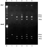 Thumbnail of Identification of Pneumocystis jiroveci dihydropteroate synthase (DHPS) genotypes. Electrophoresis on 1.5% agarose gel of DHPS polymerase chain reaction products after digestion with AccI (upper line) and HaeIII (lower line). M, molecular weight marker (123 Gibco BRL; Cergy Pontoise, France). Lane 1: double mutant genotype; lanes 2 and 5: wild genotype; lane 3: mixed infection with a wild genotype and a mutant genotype that has the mutation at nucleotide position 165; lane 4: mixed