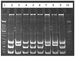 Thumbnail of Results of restriction enzyme analysis on 7% polyacrylamide gel showing the two restriction patterns obtained by digesting polymerase chain reaction products with HaeIII. Lanes 2, 4, 5, 6, and 9 show digestion of amplicons of Bartonella taylorii; lanes 3, 7, and 8 show digestion of B. grahamii amplicons; lanes 1 and 10 contain molecular weight markers.