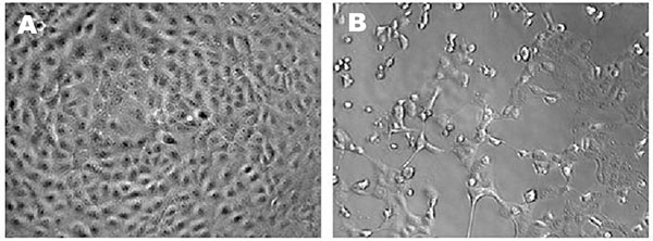 Microscopic appearance of control (a) and infected (b) Vero E6 cells demonstrating cytopathic effects.
