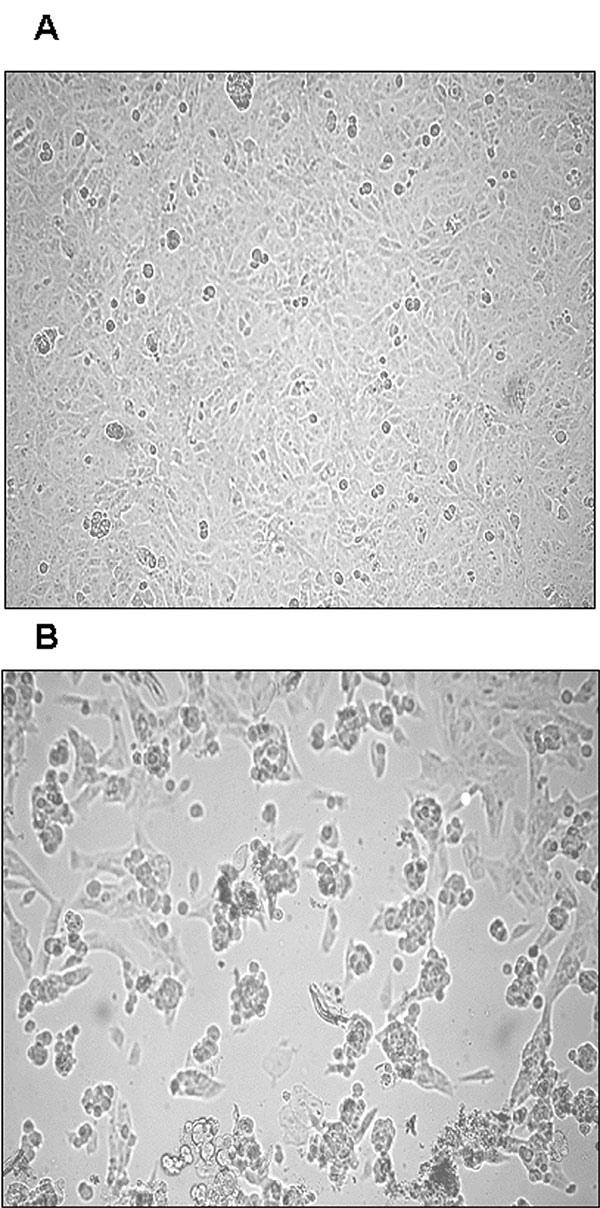 Cytopathic effect (CPE) of primary severe acute respiratory syndrome–associated coronavirus strain HSR1 isolate. A, uninfected Vero cells form a continuous monolayer of spindle-shaped cells. B, a strong CPE was observed after 24 hours of incubation of Vero cells with the patient sputum sample (primary isolate).