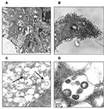 Thumbnail of Ultrastructural analysis of Vero cells infected with severe acute respiratory syndrome–associated coronavirus (SARS-CoV) strain HSR1. A, intracellular budding of SARS-CoV in large vesicles containing CoV virions (magnification x30,000); B, clusters of extracellular virions adjacent to the plasma membrane (magnification x50,000); C and D, intracellular budding of SARS-CoV virions (magnification x50,000).