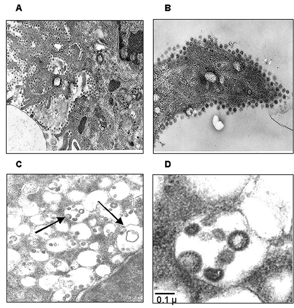 Ultrastructural analysis of Vero cells infected with severe acute respiratory syndrome–associated coronavirus (SARS-CoV) strain HSR1. A, intracellular budding of SARS-CoV in large vesicles containing CoV virions (magnification x30,000); B, clusters of extracellular virions adjacent to the plasma membrane (magnification x50,000); C and D, intracellular budding of SARS-CoV virions (magnification x50,000).