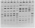 Thumbnail of Pulsed-field gel electrophoresis of Salmonella enterica serotype Enteritidis isolates from Biorat and Ratin products using XbaI (lanes 2–5) and BlnI (lanes 7–10). Lanes 1, 6, and 11, molecular weight standard strain AM01144; lanes 2 and 7, Biorat isolate from 1998; lanes 3 and 8, Biorat isolate from 1995; lanes 4 and 9, Biorat isolate from 2001; lanes 5 and 10, Ratin isolate.