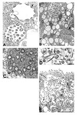 Thumbnail of Assembly of severe acute respiratory syndrome–associated coronavirus (SARS-CoV) particles in infected Vero E6 cells. A) Apposition of nucleocapsids (arrow) along membranes of the budding compartment as particles developed and budded. Nucleocapsids measured 6 nm in diameter and were mostly seen in cross-section. Some virions had an electron-lucent center, with the nucleocapsid juxtaposed to the envelope, while others were relatively dark when the nucleocapsid was present throughout t