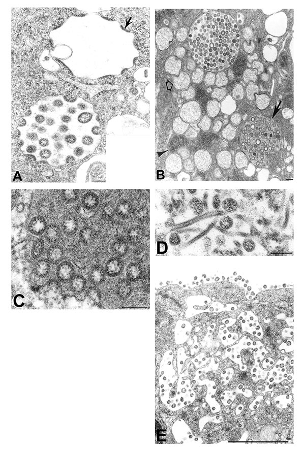 Assembly of severe acute respiratory syndrome–associated coronavirus (SARS-CoV) particles in infected Vero E6 cells. A) Apposition of nucleocapsids (arrow) along membranes of the budding compartment as particles developed and budded. Nucleocapsids measured 6 nm in diameter and were mostly seen in cross-section. Some virions had an electron-lucent center, with the nucleocapsid juxtaposed to the envelope, while others were relatively dark when the nucleocapsid was present throughout the particle.