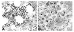 Thumbnail of Detection of viral proteins and viral RNA associated with intracytoplasmic virions. A) Immunogold labeling of viral proteins by using hyperimmune mouse ascitic fluid directed against severe acute respiratory syndrome–associated coronavirus (12 nm gold). B) Ultrastructural in situ hybridization detection of viral RNA by using a pool of polymerase and nucleocapsid riboprobes (6 nm gold). Bars, 100 nm.