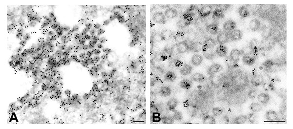 Detection of viral proteins and viral RNA associated with intracytoplasmic virions. A) Immunogold labeling of viral proteins by using hyperimmune mouse ascitic fluid directed against severe acute respiratory syndrome–associated coronavirus (12 nm gold). B) Ultrastructural in situ hybridization detection of viral RNA by using a pool of polymerase and nucleocapsid riboprobes (6 nm gold). Bars, 100 nm.