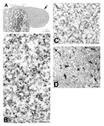 Thumbnail of Immunogold and in situ hybridization (ISH) labeling of severe acute respiratory syndrome–associated coronavirus–infected cells. A) Cytoplasmic area that is relatively free of organelles (arrow). B) At higher magnification, these regions are shown to consist of ribosomelike and filamentous structures. Within these regions, C) viral proteins are detected by immunolabeling, using hyperimmune mouse ascitic fluid (12 nm gold), and D) ultrastructural ISH detects viral mRNA, genRNA, or bot