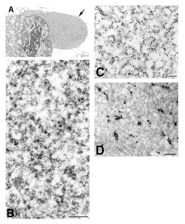 Immunogold and in situ hybridization (ISH) labeling of severe acute respiratory syndrome–associated coronavirus–infected cells. A) Cytoplasmic area that is relatively free of organelles (arrow). B) At higher magnification, these regions are shown to consist of ribosomelike and filamentous structures. Within these regions, C) viral proteins are detected by immunolabeling, using hyperimmune mouse ascitic fluid (12 nm gold), and D) ultrastructural ISH detects viral mRNA, genRNA, or both, by using a