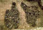 Thumbnail of Partial view of the grave in Dreux investigated in this work, which illustrates anthropologic features of a mass grave suitable for paleomicrobiology research.