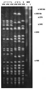 Thumbnail of Pulsed-field gel electrophoresis of the three strains of vancomycin-dependent enterococci (VDE) and, in two cases, a vancomycin-resistant enterococci (VRE) strain isolated before the VDE in the same patient. The three VDE strains appear to be genetically distinct, although two may be related. In both cases in which VRE was isolated before VDE, VRE and subsequent VDE strains appear genetically identical. RFLP, restriction fragement length polymorphism; MW, molecular weight; λ, lambda