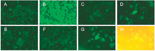 Detection of the severe acute respiratory syndrome-associated coronavirus (SARS-CoV) in the epithelial cells in throat wash from SARS patients by an indirect immunofluorescence assay. (A,B) Spot slides of SARS-CoV-infected Vero E6 cells were incubated with the preimmune (A) or postimmune (B) serum from a rabbit immunized with the recombinant nucleocapsid protein of the SARS-CoV, followed by fluorescein isothiocyanate–conjugated goat anti-rabbit immunoglobulin G. Panels A and B demonstrate the sp