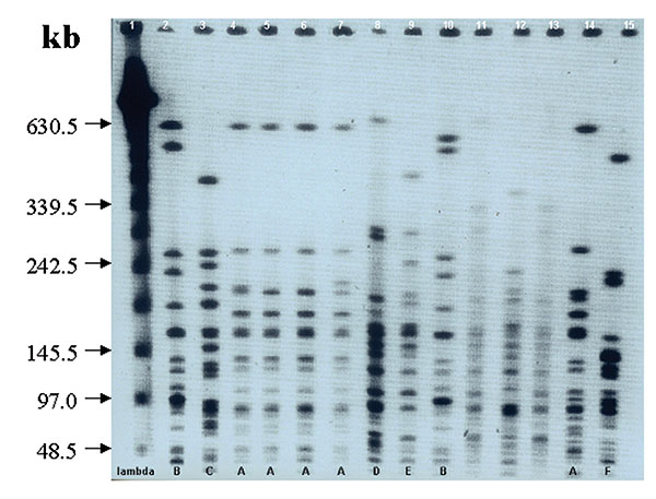 A typical pulsed-field gel electrophoresis analysis of selected isolates of A. baumannii restricted with ApaI. Lane 1 shows λ ladder used as molecular size marker. Lanes 11–13 are of strains not included in the trial. The gel shows 6 different clones of A. baumannii: 5 isolates belong to clone A and that 2 belong to clone B (the two dominant clones). Single isolates belonging to clones C, D, E, and F can be seen.