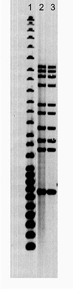 Thumbnail of Ten-band Mycobacterium tuberculosis restriction fragment length polymorphism pattern. Lane 1, 25-band Centers for Disease Control and Prevention standard; lane 2, human case; lane 3, canine case.