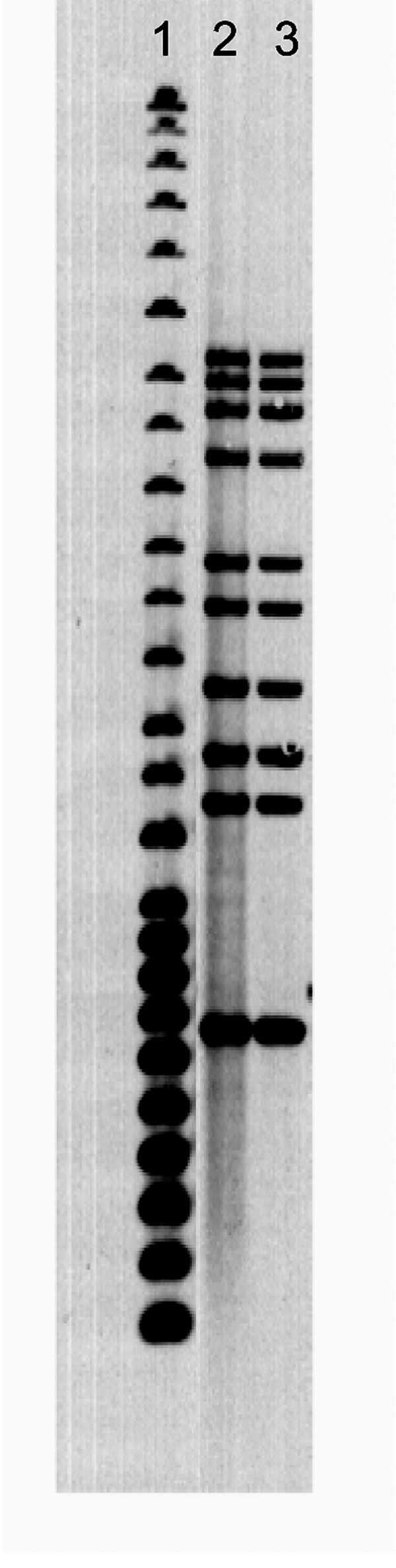 Ten-band Mycobacterium tuberculosis restriction fragment length polymorphism pattern. Lane 1, 25-band Centers for Disease Control and Prevention standard; lane 2, human case; lane 3, canine case.