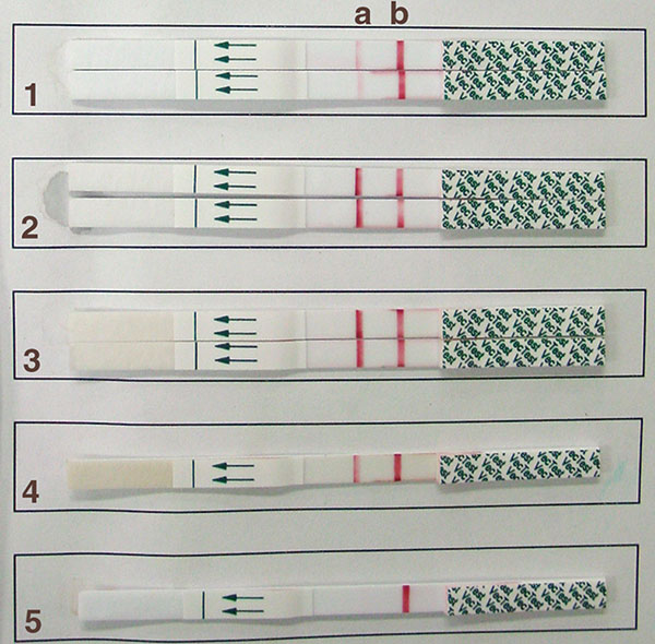 Results of testing by the VecTest assay. Each strip has a test zone (a) and a positive control zone (b). Samples 1–3 were run in duplicate. Note the difference in band intensity between sample 1 vs. samples 2 and 3 (all three are positive). Sample 4 was a positive control and sample 5 was a negative control.