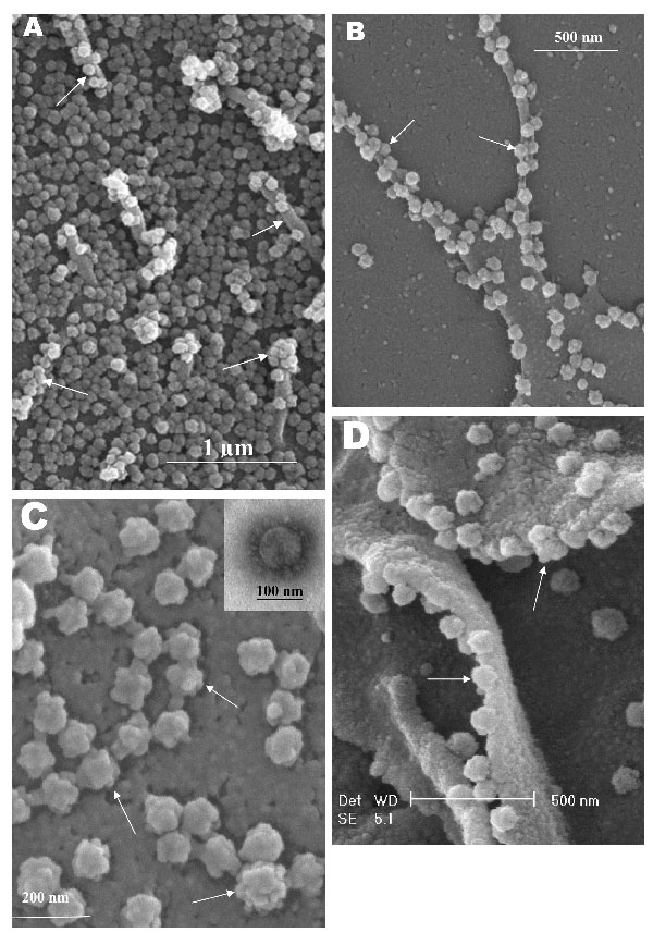 Scanning electron microscopy of Vero E6 cells infected with severe acute respiratory syndrome–associated coronavirus at 24 h after infection. A) Cell surface is covered with extracellular progeny virus particles, and progeny virus are being extruded from or attached to numerous pseudopodia on infected cell surface (arrows). B) A higher magnification micrograph of the virus-clustered pseudopodia (arrows). C) Rosettelike appearance of the matured virus particles (arrows). The scanning electron mic