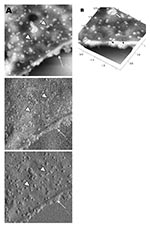 Thumbnail of Atomic force microscopy of Vero cells infected with severe acute respiratory syndrome–associated coronavirus. A) High activity of virus extrusion at the thickened edge of the infected cells (arrow). Arrowheads indicate virus particles. B) A three-dimensional reconstruction of the image in panel A shows the puffy edge of infected cells. Many intracellular viruses are visible just under the plasma membrane (arrows). Extruded virus particles are present on other areas of the cell surfa