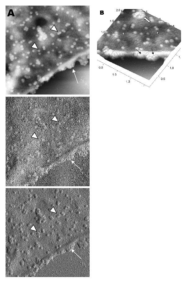Atomic force microscopy of Vero cells infected with severe acute respiratory syndrome–associated coronavirus. A) High activity of virus extrusion at the thickened edge of the infected cells (arrow). Arrowheads indicate virus particles. B) A three-dimensional reconstruction of the image in panel A shows the puffy edge of infected cells. Many intracellular viruses are visible just under the plasma membrane (arrows). Extruded virus particles are present on other areas of the cell surface (arrowhead