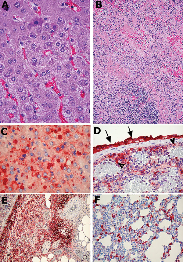 Representative photomicrographs of histologic changes and immunohistochemical staining of tissues from ground squirrels infected with monkeypox virus. A) Liver from a ground squirrel (intranasal infection) showing mild degenerative changes, including early steatosis, and purple-colored viral cytoplasmic inclusion bodies in the hepatocytes (40x objective). B) Spleen from a ground squirrel infected intraperitoneally, showing extensive necrosis (20x objective). C) Liver showing positive antigen sta