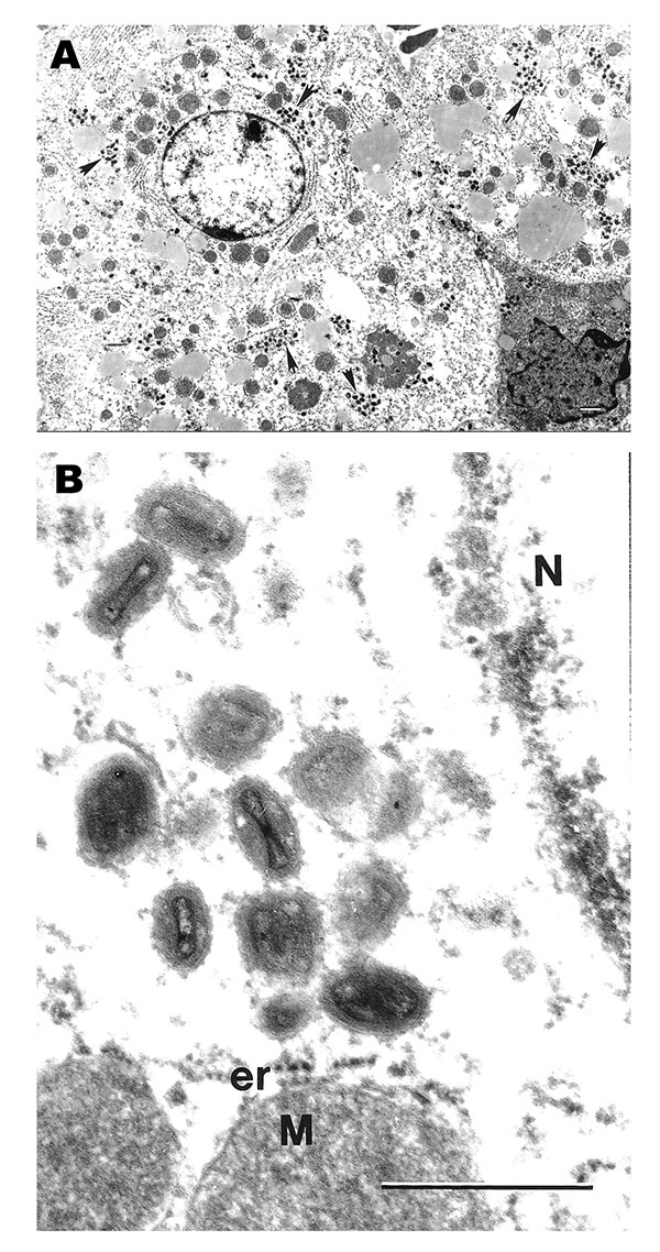 Ultrastructural localization of monkeypox virus in hepatocytes in the liver of a ground squirrel 5 days after infection. A) Hepatocytes contain numerous groups of virions (arrows) in their cytoplasm (bar = 1 μm). B) Magnified area of A, showing typical ultrastructure of monkeypox virus virions and characteristic hepatocyte mitochondria (M) surrounded by cisterns of granular endoplasmic reticulum (er). N, fragment of hepatocyte nucleus; bar = 0.5 μm.