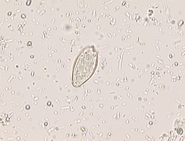 Opisthorchis-Clonorchis egg detected in the stool of one patient.