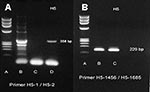 Thumbnail of A reverse transcription–polymerase chain reaction (RT-PCR) specific for H5 gene band (358 bp) of avian influenza H5N1 that was recovered from our patient from nasopharyngeal aspirates by using H5-1/H5-2 primer. Lane A, molecular standard; lane B, H5 band isolated from our patient (358 bp); lane C, negative control; lane D, positive control. B. RT-PCR specific for H5 gene band (229 bp) of avian influenza (H5N1) that was recovered from our patient from nasopharyngeal aspiration by usi