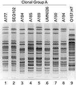 Thumbnail of XbaI pulsed-field gel electrophoresis profiles of Escherichia coli clonal group A (CGA) isolates and E. coli O157:H7. Lane numbers are shown below the gel image. Six CGA isolates from Chicago, IL (“A” series identifiers; lanes 1, 3, 4, 5, 7, and 8) exhibit similar profiles to reference CGA isolates SEQ102 (from California; lane 2) and UMN26 (from Minnesota; lane 6) (1). E. coli O157:H7 isolate G5244 (lane 9) exhibits a distinctive profile.