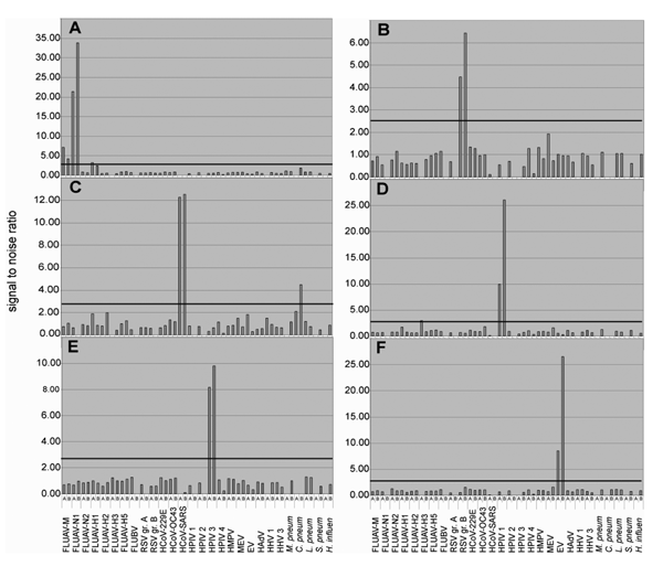 Analysis of clinical specimens. RNA extracts from clinical specimens containing known pathogens were reverse transcribed into cDNA (Superscript RT system, Invitrogen, Carlsbad, CA; 20-µL volume). Five microliters of the reaction were subjected to Mass Tag PCR by using primers coupled to Masscode tags (Qiagen Masscode technology, Qiagen, Hilden, Germany). Detection of (A) influenza virus A (H1N1), (B) respiratory syncytial virus (RSV) group B, (C) human coronavirus SARS (HCoV-SARS), (D) human par