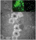 Thumbnail of As observed by scanning electronic microscopy, mimivirus antigen (A) is recognized by antibodies in our microimmunofluorescence assay using conventional fluorescence microscope (B) and confocal microscope (C). Mature particles within amebas are also recognized by antibodies seen with transmission electronic microscopy immunogold technique (D) (mimivirus particle size 400 nm).