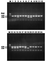 Thumbnail of Agarose gel electrophoresis analysis on 1.5% agarose gel of DNA sequences amplified by multiplex-nested polymerase chain reaction (PCR) assay by using outer and inner primer sets targeted rompB gene and template DNAs from serum samples. Lanes: M, size marker DNA (100-bp DNA ladder); 1–24, each number of amplified H products. The number on the left indicates the molecular size (in bp) of the amplified PCR products.