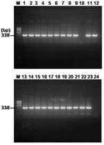 Thumbnail of Agarose gel electrophoresis analysis on 1.5% agarose gel of DNA sequences amplified by nested polymerase chain reaction (PCR) assay using primer sets targeted partial gltA gene and template DNA sequences from 24 serum samples. Lanes: M, size marker DNA (100-bp DNA ladder); 1–24, each number of amplified gltA products. The number on the left indicates the molecular size (in base pairs) of the amplified PCR products.