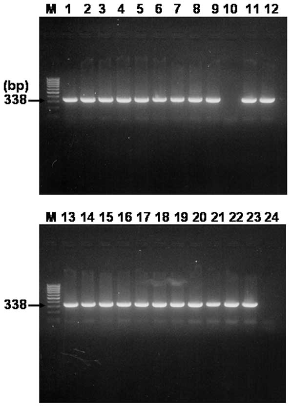 Agarose gel electrophoresis analysis on 1.5% agarose gel of DNA sequences amplified by nested polymerase chain reaction (PCR) assay using primer sets targeted partial gltA gene and template DNA sequences from 24 serum samples. Lanes: M, size marker DNA (100-bp DNA ladder); 1–24, each number of amplified gltA products. The number on the left indicates the molecular size (in base pairs) of the amplified PCR products.