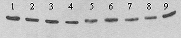 Western blot showing differing mobility of E proteins from nine plaque-purified variants of West Nile virus (WNV) strain TM-171 Mex03. Nucleotide sequencing of strains in lanes 5 to 9 indicated the presence of an “NYS” glycosylation motif at residues 154 to 156 of E, while strains in lanes 1 to 4 encoded “NYP.” Antigens were separated in a nonreducing 5%/10% discontinuous sodium dodecyl sulfate–polyacrylamide gel, transferred to 0.2 μm nitrocellulose and detected with WNV-specific monoclonal ant